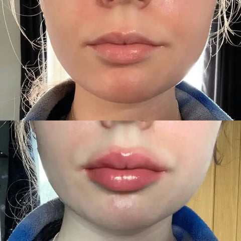 Plump N' Pout™ Viral Lip Plumping Oil v3